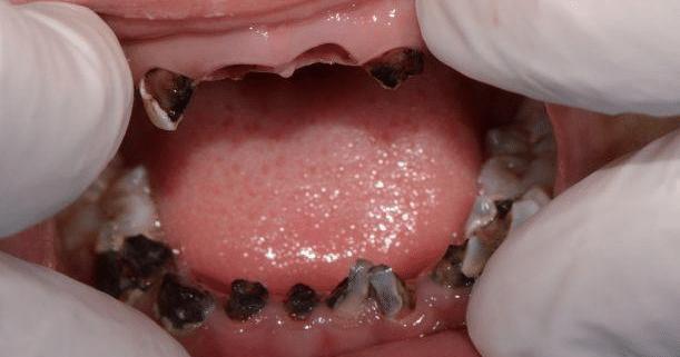 电动牙刷|牙齿|刷牙_新浪新闻