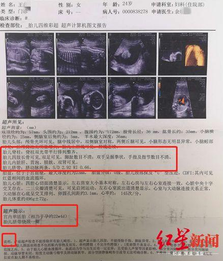 在达州市中心医院的四维彩超报告上,检查