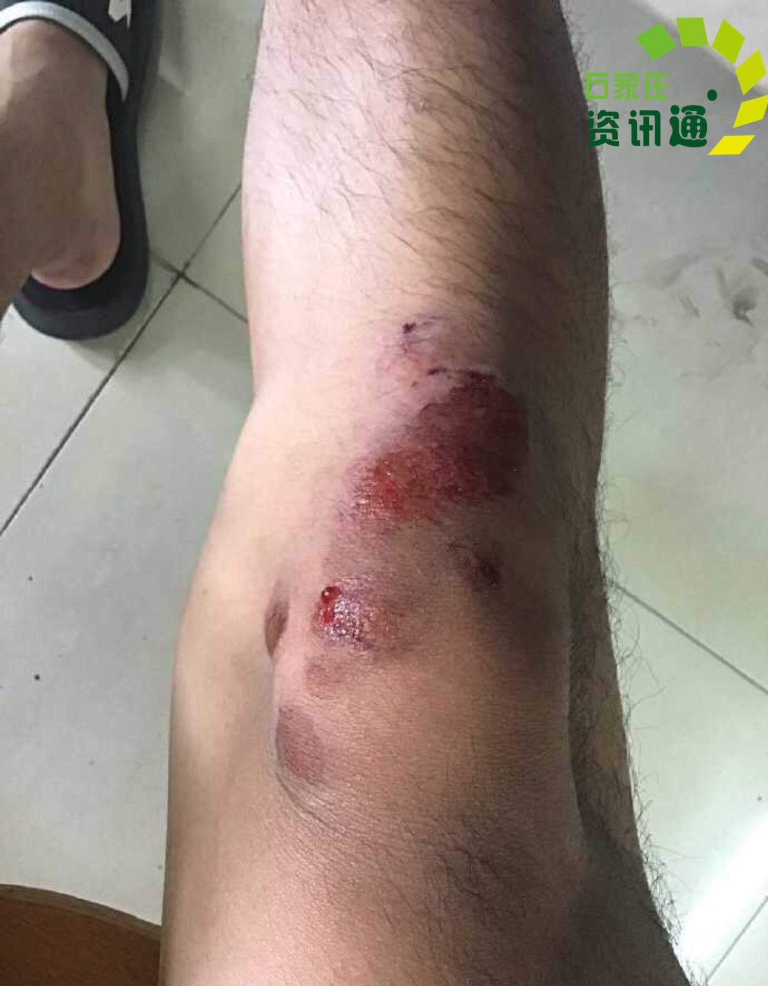 石家庄街头一电动车妇女速度快撞伤人后逃之夭夭道德何在