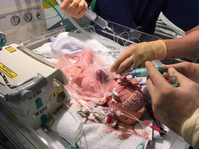 女婴心脏竟长在体外!不想宝宝有先天缺陷家长该这么做