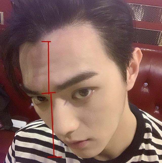 许凯晒自拍发际线堪忧,自嘲许家第一个m字头