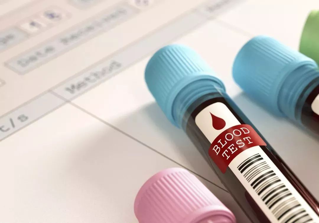 一滴血测癌究竟是真是假 日本当事企业回复 癌症 肺癌 滴血测癌 新浪新闻