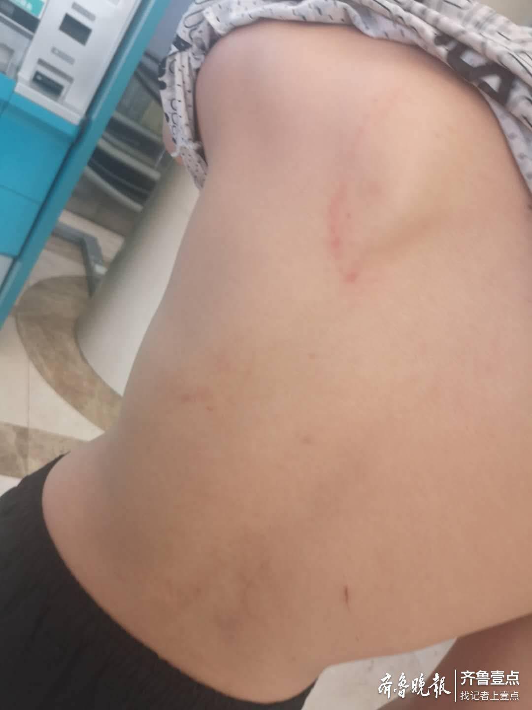 伤口,一颗门牙缺损了一半,只剩下牙根部位,其后背也有多处红肿和伤痕