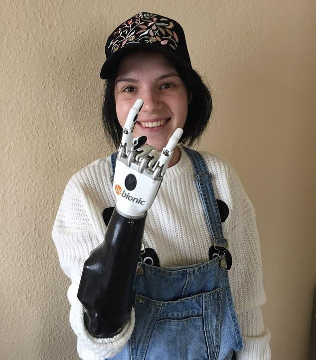 俄罗斯美女遭丈夫砍断双臂安装机械手臂拍摄性感艺术照