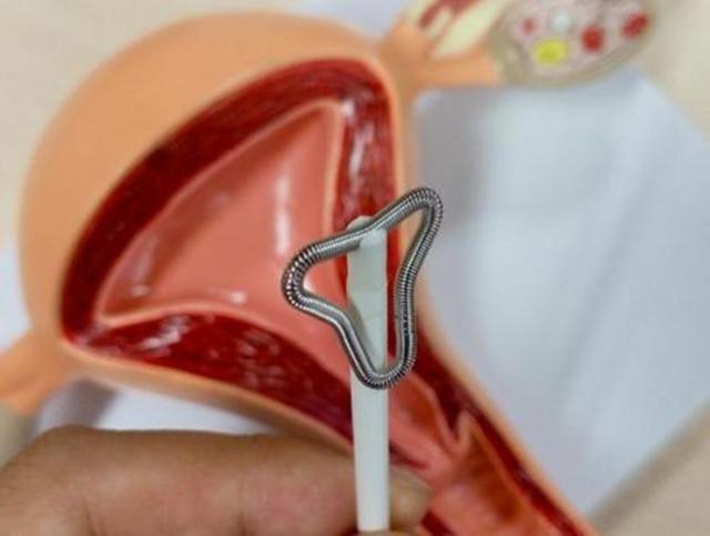 不要认为不可能,别忘了那个举着"环"出生的孩子