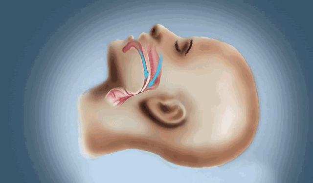 尤其是平时兼有反酸,烧心,咳嗽,哮喘样发作,前胸后背放射痛等症状的