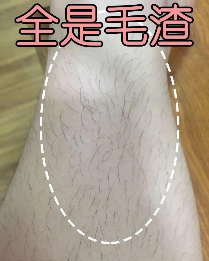 夏天想露大长腿你的腿毛答应吗
