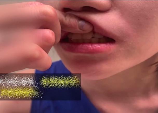 为了100元麻辣烫争吵,浙江19岁女子被撞崩牙齿