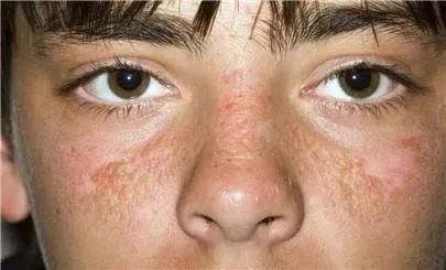 常在户外,对抗暴晒需要这款防紫外线50 神器|皮肤|紫外线|防晒霜_新浪