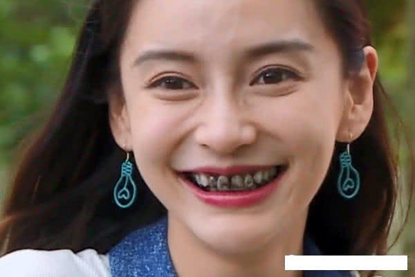 baby有多信任李晨?看到一口白牙变成黑牙的瞬间,心疼又好笑