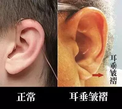 人猝死前身体发出两个救命信号一定要清楚关键时可保命