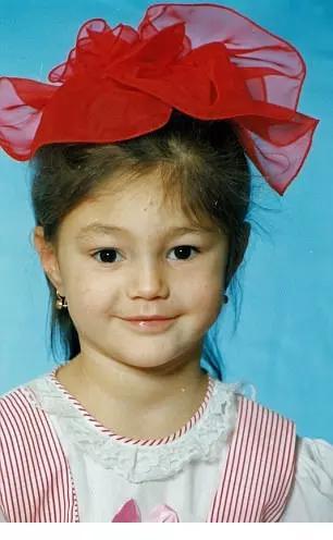 其实小时候的莉莉长得十分漂亮,那时的她还是一个健康的孩子,不过到了