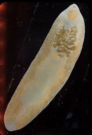 饭吃得好好的 怎么就多了条寄生虫 财经头条 饭吃得好好的 怎么就多了条寄生虫 财经头条