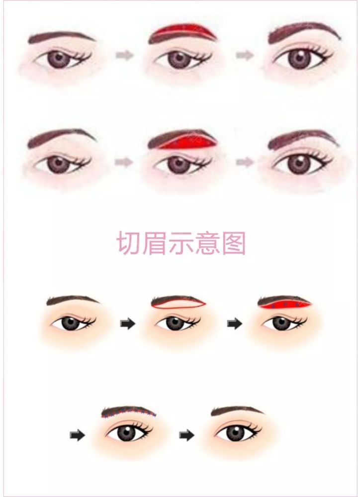 切眉与提眉的区别,到底哪个好|切眉|提眉|手术_新浪新闻