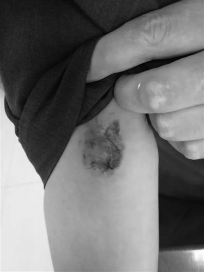 暴力抗法艾滋病毒携带者咬伤执行人员被批捕