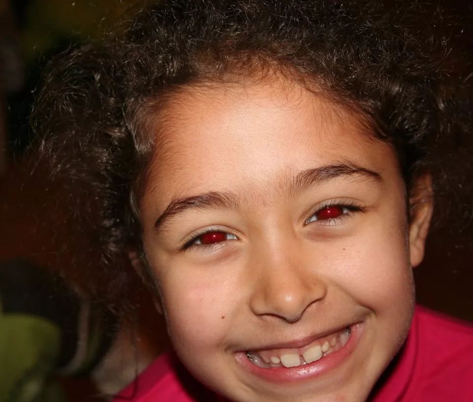 妈妈给4岁女儿拍照无意打开了手机闪光灯竟救了孩子的命