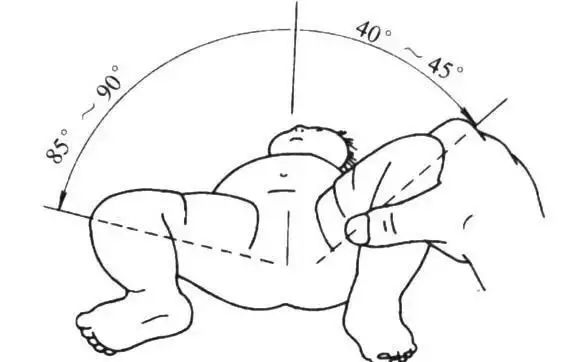 髋关节脱位|不对称|宝宝_新浪新闻
