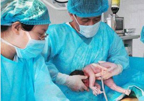 宝妈顺产经历其实遇上这种情况男医生比女医生接生更好