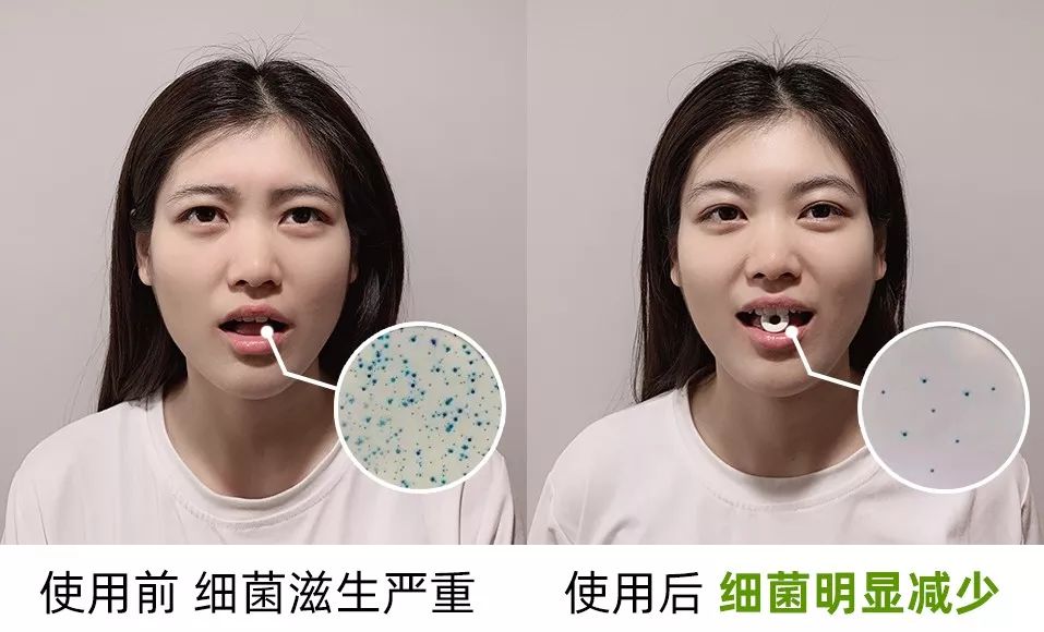 万年口臭3秒除吃大蒜都不怕连打嗝都是香的