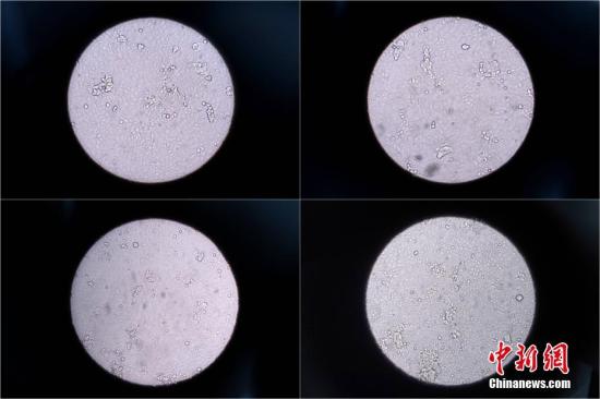 香港科技大学研发新仪器30分钟检测数百种病毒 仪器 新浪新闻