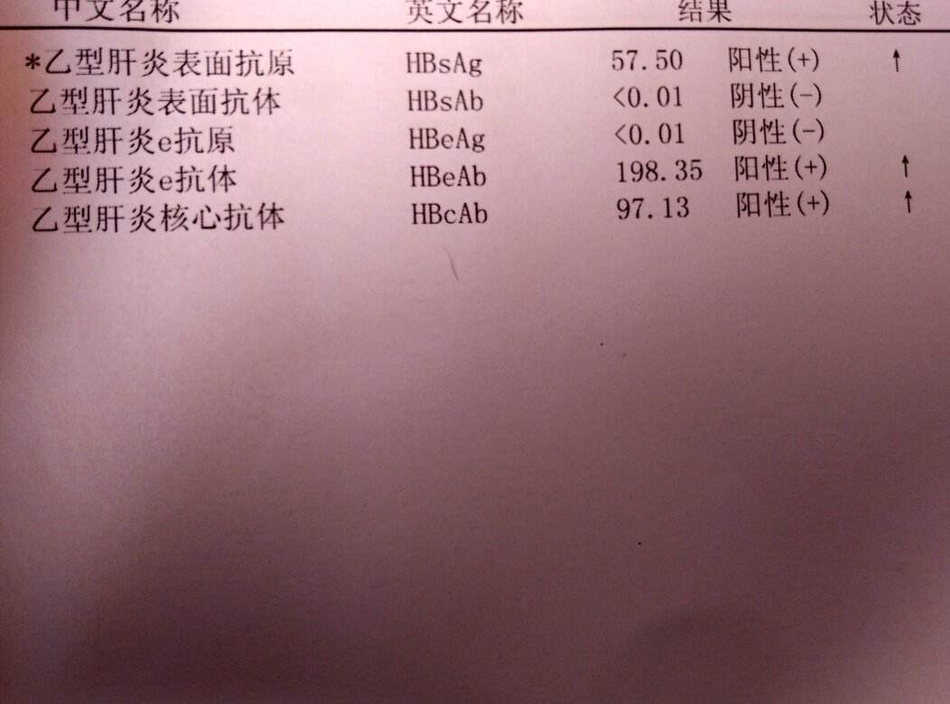 缓解肝区不适乙肝小三阳切忌过饱采取胸式呼吸减轻腹压