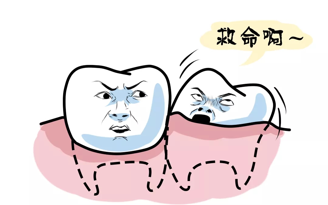 有一种疼叫智齿疼智齿到底该不该拔