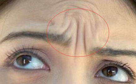 一个人的印堂纹,能看出他到底是穷命还是富命,你能看出自己的吗