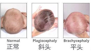 奶奶和姥姥吵着给孩子睡平头,家长这样做,宝宝头型才完美