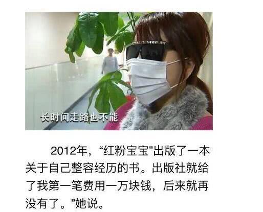 整容达人红粉宝宝公开最新照片,双腿变成o型腿,靠止痛药度日