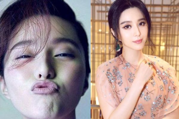 4大明星金鱼嘴:赵丽颖可爱