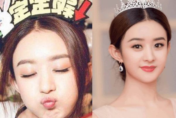4大明星金鱼嘴:赵丽颖可爱