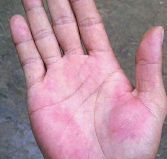 越来越多的人,受到胃病的折磨,而中国,更是胃癌大国,约一半的胃癌