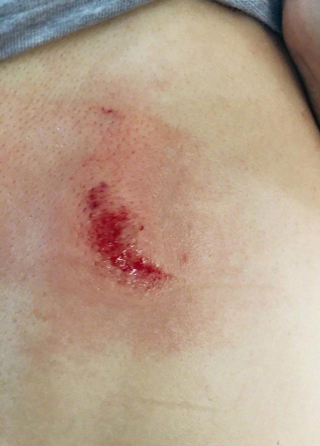 军嫂张馨予发文晒受伤照片,家里乱成一团,香水洒满地