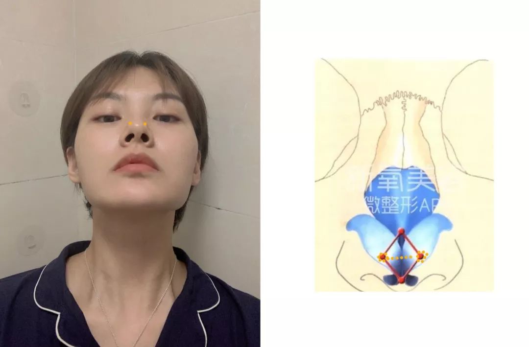这么多女明星一个个正面都露鼻孔是怎么回事?|鼻孔|鼻翼|鼻头_新浪新闻