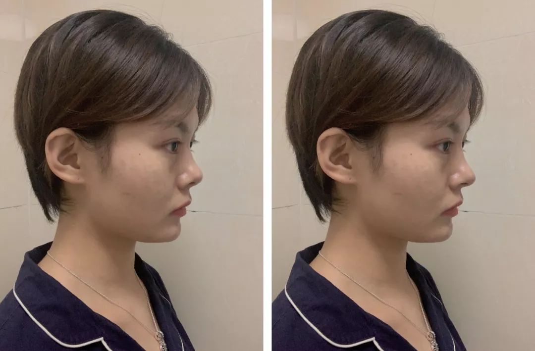 这么多女明星一个个正面都露鼻孔是怎么回事?|鼻孔|鼻翼|鼻头_新浪新闻