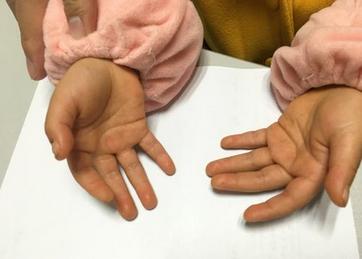 医生:错误喂养方式太坑娃|胡萝卜素|宝宝|血症_新浪新闻