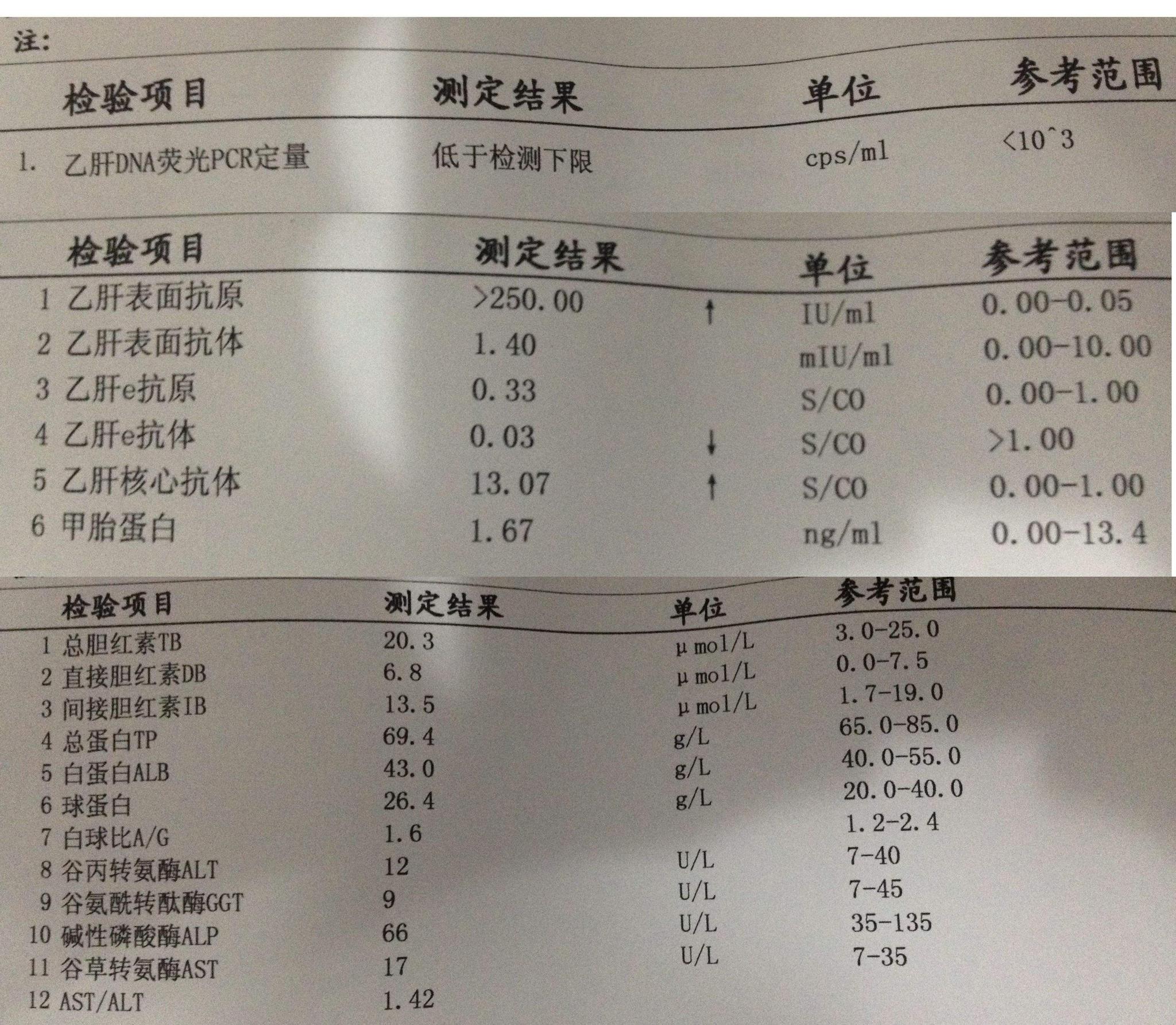 病程拖延越長抗病毒治療越不理想乙肝小三陽應早監測指標異常