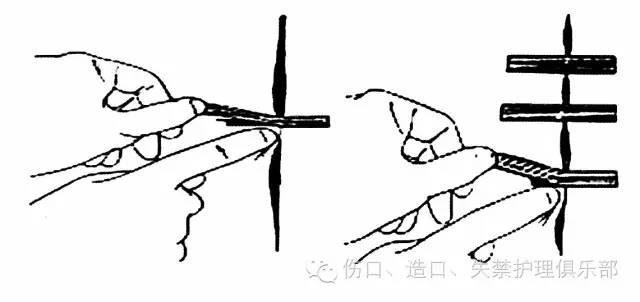 伤口敷料粘贴技巧|敷料|胶布|伤口_新浪新闻