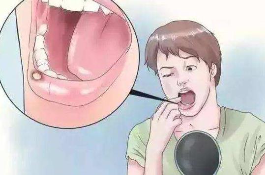 嘴上总是容易长泡?多半是这5种口腔疾病,去看看吧!