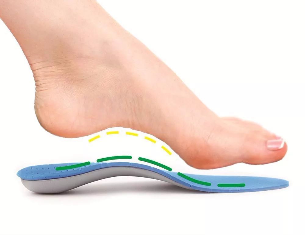 高足弓患者选择有一定足弓支撑,系带类的鞋子,可自由调节鞋面的高度