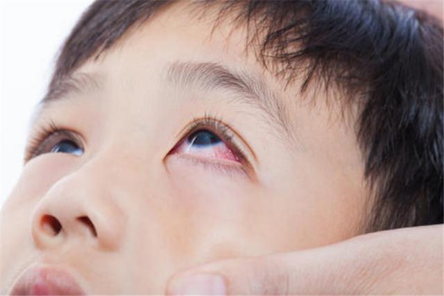 带娃游泳好处多?父母不要乱跟风,避免孩子染上"红眼病"