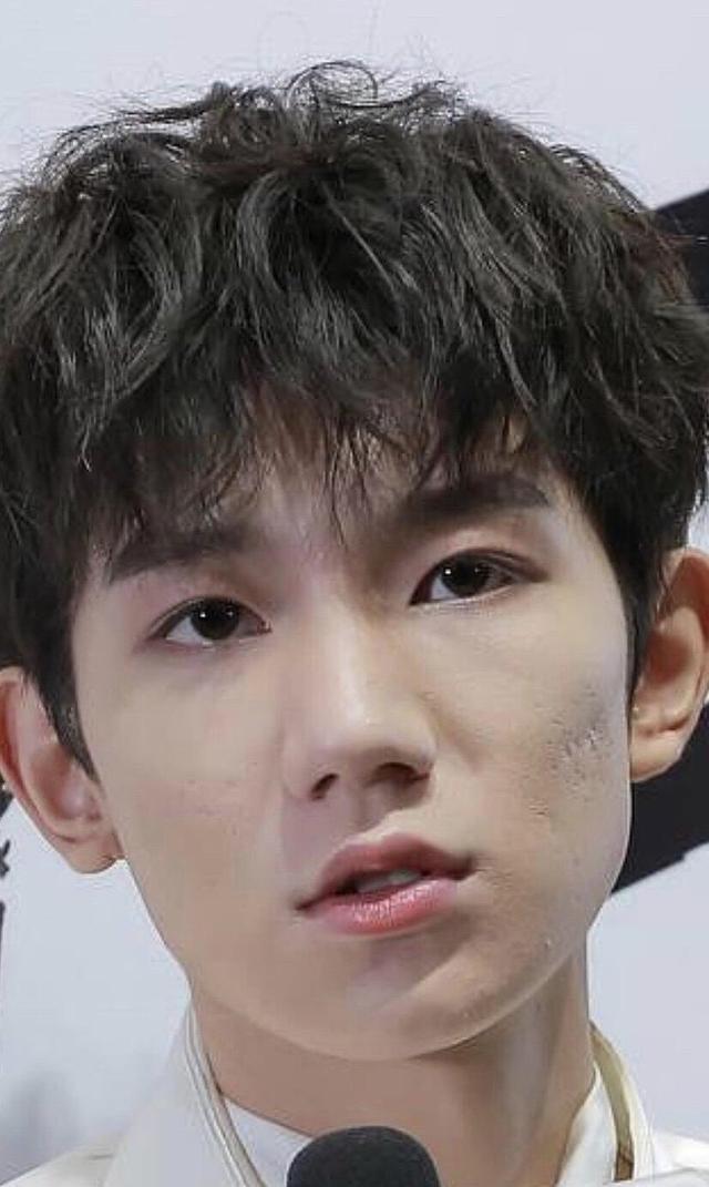 王源多次被拍到脸上"坑坑洼洼",易烊千玺baby热巴也曾爆痘