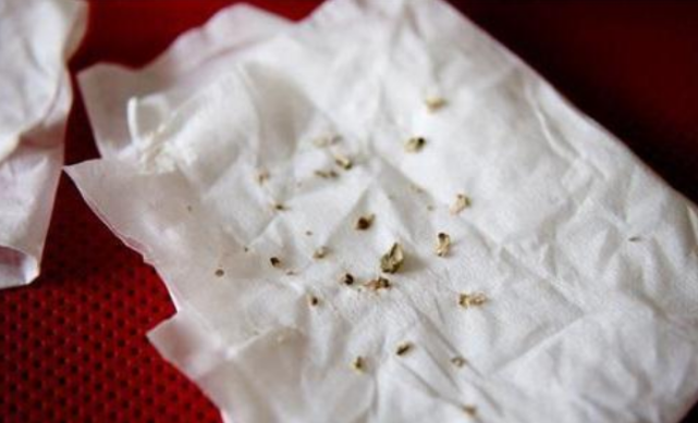 牙齿一天两刷还是有牙结石教你两个土方法牙垢掉得快