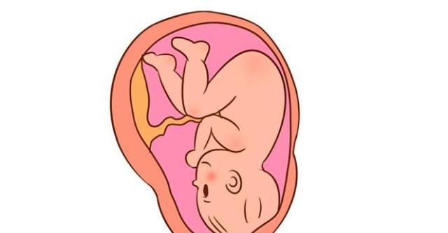 胎位rsa是什么位置图片