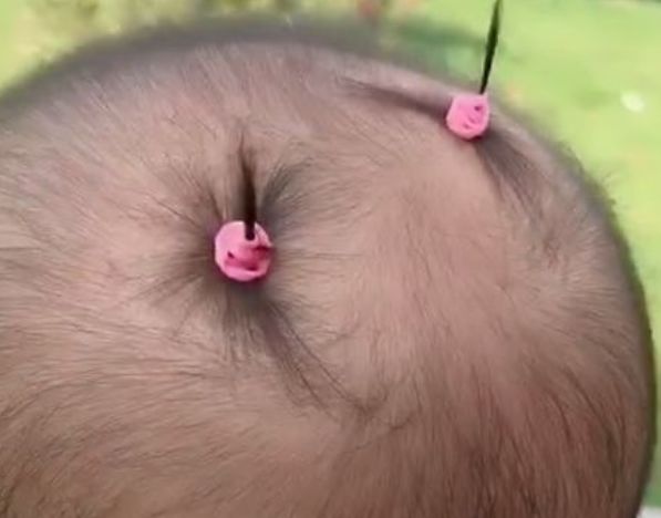 1岁女宝天生头发少,宝妈为了让她自信扎了辫子,家人无法淡定了|头发|