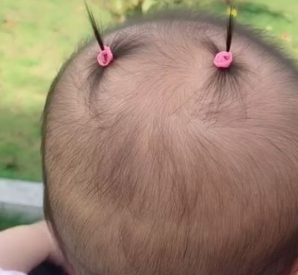1岁女宝天生头发少,宝妈为了让她自信扎了辫子,家人无法淡定了