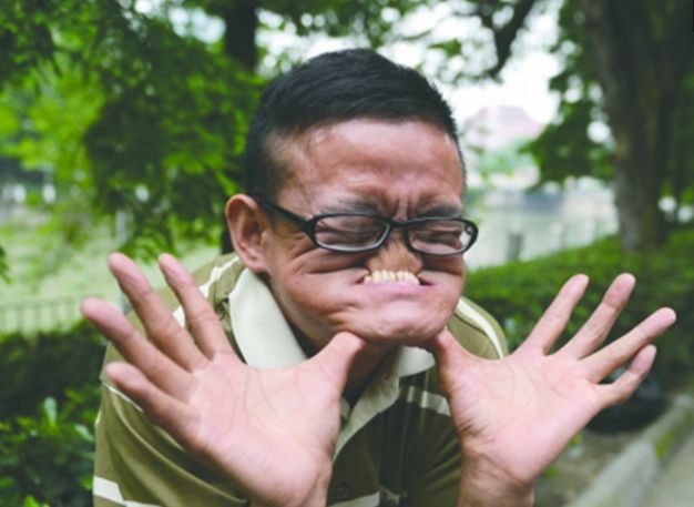 见到这样的丑脸,你会被吓倒吗?知道真相你会佩服他!