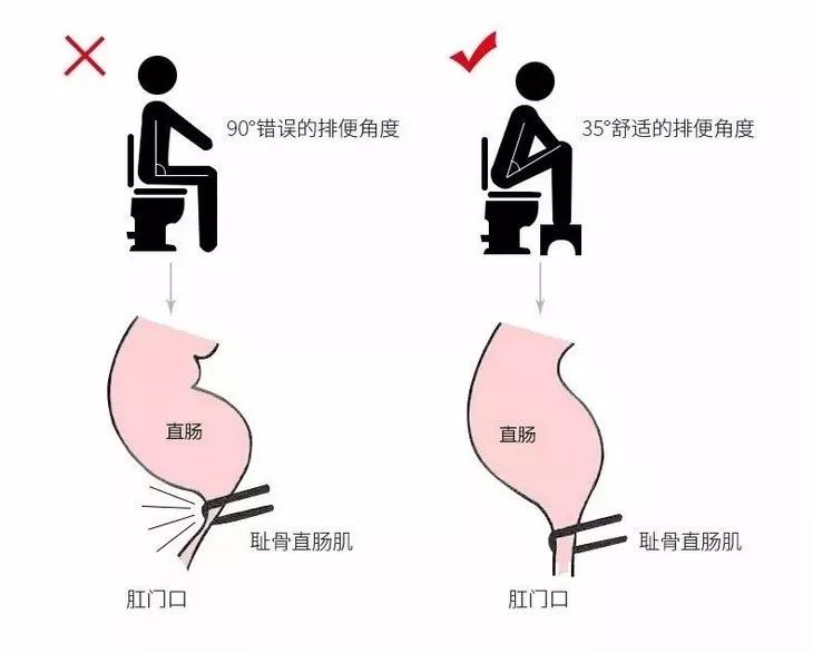 用了这么多年的马桶居然用错了幸亏它拯救了我多年的老便秘