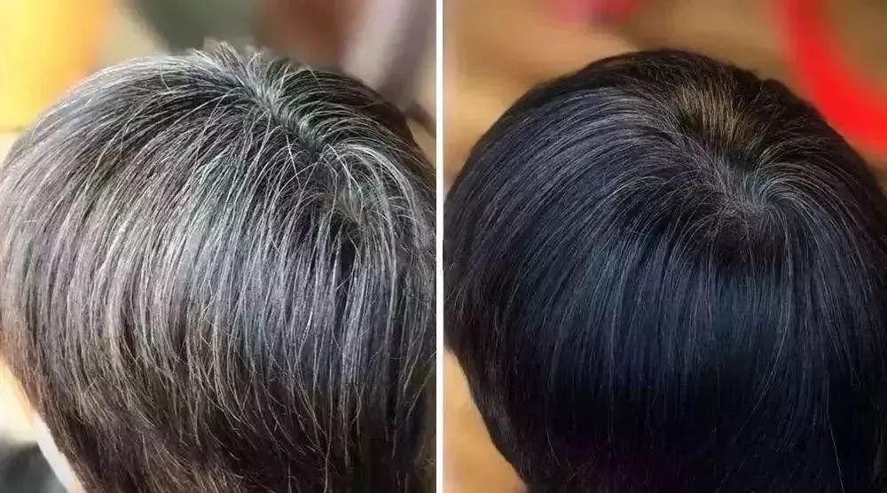 头顶稀疏的男人,没有未来.|头发|头皮|头顶_新浪新闻