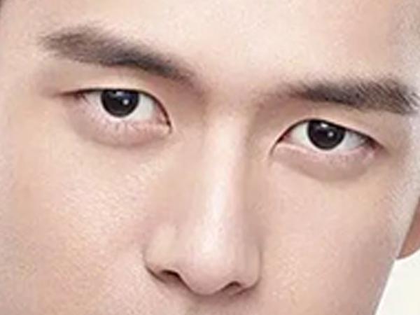 所谓的三角眼,就是上眼睑呈一直线,但在下面泪堂处却形成斜尖的一个倒